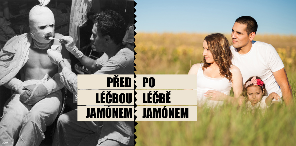 Spanje: Het eten van jamón de bellota verlaagt het risico op de ziekte van Alzheimer - Jamon.be